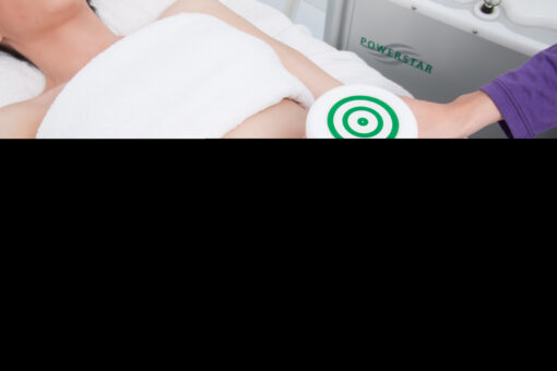 TRATAMIENTO PERDIDA DE VOLUMEN 299€