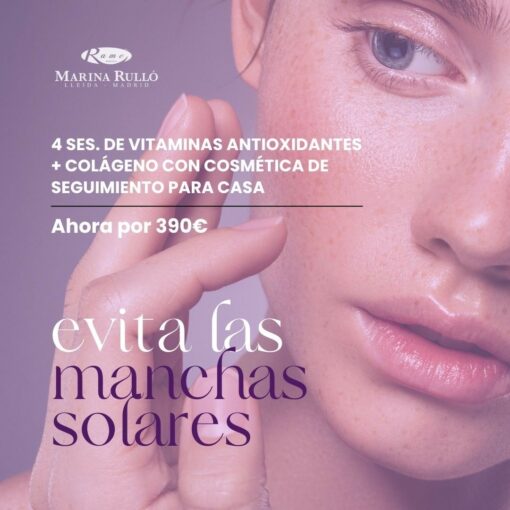 EVITA LAS MANCHAS SOLARES