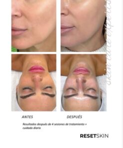 RESET SKIN EFECTO GLASS SKIN