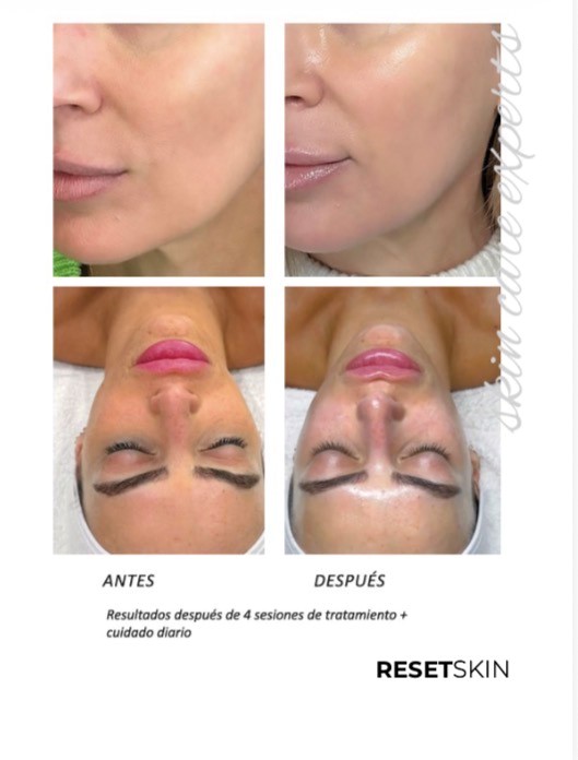 RESET SKIN EFECTO GLASS SKIN